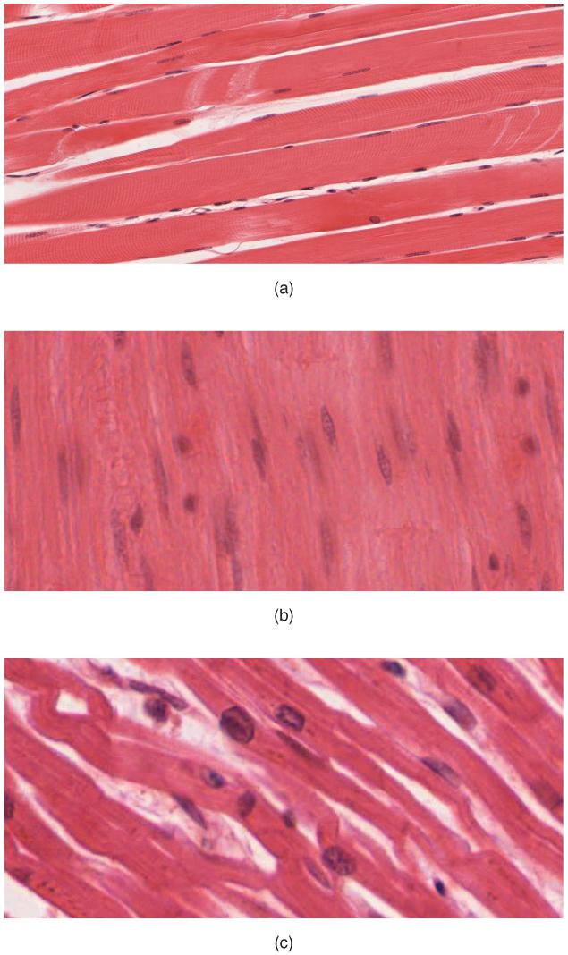 Muscle Tissue (a) Skeletal muscle cells have prominent striation and nuclei on their periphery. (b) Smooth muscle cells have a single nucleus and no visible striations.