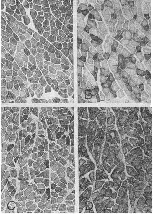 Examples of 120 day self- and cross-innervated FDL stained for PL and SD. A: self-innervated FDL stained for PL.