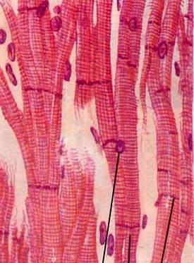 collateral branch LM of cardiac muscle fiber