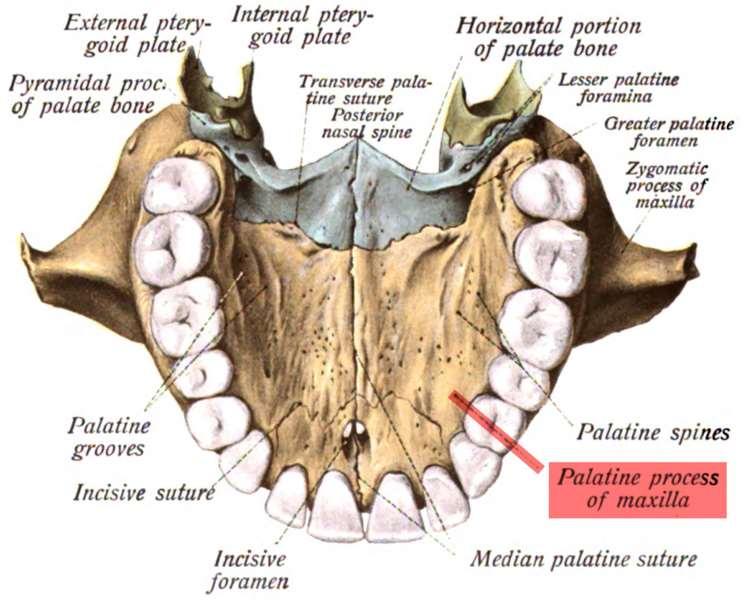 Residual alveolar ridge (R A R): the horse shoe shaped ridge or remaining portion after extraction of teeth overlying on the maxilla & palatine bone. It considered primary stress bearing area.