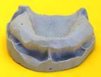 Staub Cranial See the end from the beginning with Staub Cranial Recently a new technology was introduced to the United States that will revolutionize the way our industry restores teeth.