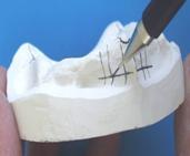 Dental technicians seldom see the patient and are left to manufacture what they believe a restoration should look like.