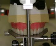 (Figure 10) The Ortho 2A is removed from the articulator and replaced with the Ortho 3A.