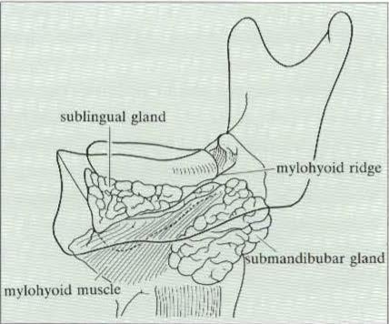Sub lingual gland area Sub lingual gland lies above the mylohyoid muscle & is raised by the muscle during