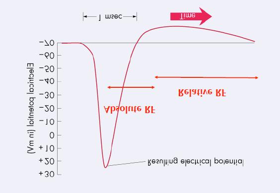 (above diagram shows voltage levels/time periods at which the AP and RP occur) Please note: RF in diagram should read RP Absolute RP it is impossible for another action potential to be fired during