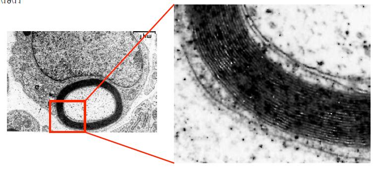 (above diagram is micrograph of myelin) Saltatory conduction increases speed of neural transmission from 10 milliseconds to 120 milliseconds MS (or Multiple Sclerosis) is a disease that affects