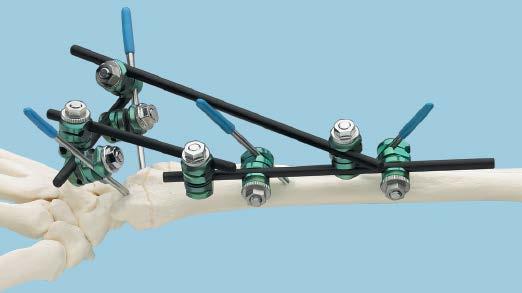Ensure that all clamps are tight. See Optional Frame Configurations page for sample frames.