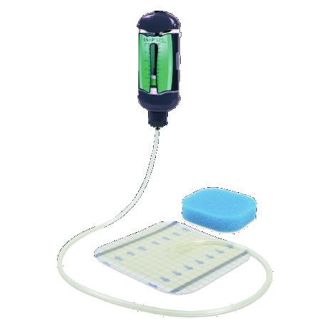 1 Mechanically powered and portable for patient mobility Delivers clinically proven -125mmHg continuous negative pressure Indicated for identical wound types as V.A.C.