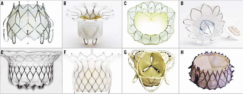 Transcathter Mitral Valve Replacement - Device Landscape and Stage of Development - (A)CardiAQ valve system: Feasibility Trial (B) FORTIS valve: on hold (C)Tiara: Feasibility trial (D)Tendyne Valve: