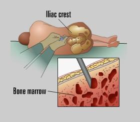 Unit 1: 3: Introduction Procedure What are the Risks? Needle biopsy is minimally invasive and is typically a very safe procedure. The benefits of percutaneous biopsy often far outweigh the risks.
