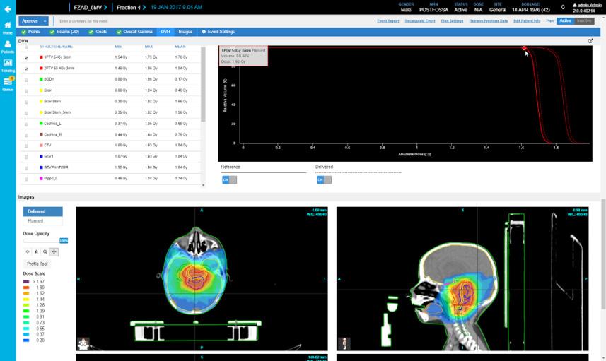 Phantomless Pre-Treatment QA SunCHECK Patient supports 3D CRT, IMRT/VMAT and SRS/SBRT calculation and delivery.