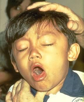Bordetella pertussis Pertussis bacteria causes whooping cough.