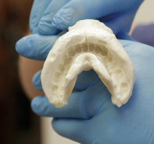 Dental Laboratories Dental prostheses, appliances, and items used in their making are potential sources