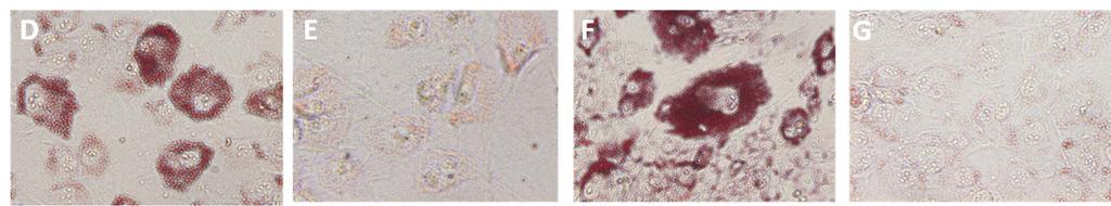 Zfp423 in adipogenesis of fibro/adipogenic progenitor cells