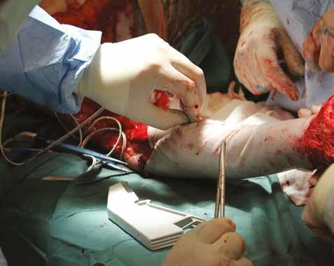 Application in operating rooms