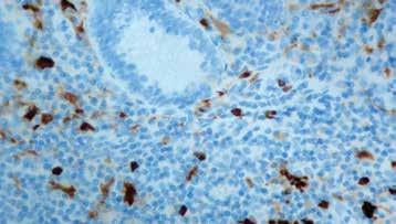 Immunogen: BALB/C mice were immunized with purified bovine brain S-100 protein Isotype: IgG2a Positive Control: Melanoma Specificity: This antibody stains with S-100 protein.