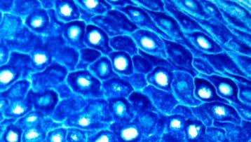 PermaBlue/AP is a substrate chromogen system for use with alkaline phosphatase (AP) detection in immunohistochemistry (IHC) or in situ hybridizations (ISH).
