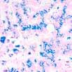 pylori stain blue, mast cells stain dark blue with red granules, nuclei stain blue to violet and the cytoplasm stains light blue.