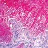 : KT 015 This kit stains fungi and Pneumocystis carinii in paraffin tissue sections.