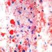 : KT 018 This kit stains Gram-positive and Gram-negative bacteria in paraffin tissue sections.