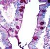 : KT 035 This kit stains fungi, Helicobacter pylori, Legionella pneumophila and Spirochetes in paraffin tissue sections.