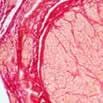 Trichrome Stain Catalog No.: KT 034 This kit stains collagen and muscle in paraffin tissue sections.