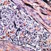 Bone tissue stained with Von Kossa stain (KT 028). Special Stains P.T.A.H. Catalog No.