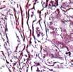 The collagen stains brownish red to red, fibrin and muscle stain blue, while the nuclei stain dark blue. Reticulum Catalog No.