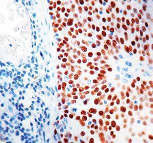 Diagnostic BioSystems Diagnostic BioSystems offers an entire range of ready-to-use and concentrated antibodies optimized to provide high quality staining when used for immunohistochemical