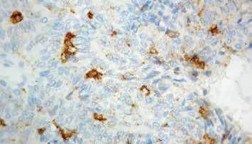 Positive Control: Colon carcinoma Specificity: This antibody reacts specifically with sialyl Lewis a and recognizes an epitope being designated CA 19-9.