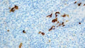 It stains the sweat ducts and glands in the skin, islets cells, and granules of pancreatic acini. CD1a Clone: O10 Catalog No.: Mob 363 Concentrated 1ml Mob 363-05 Concentrated 0.