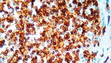 It stains human T cells in both the cortex and medulla of the thymus and in peripheral lymphoid tissues.