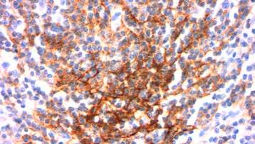 Immunogen: BALB/C mice were injected with human tonsil B cells.