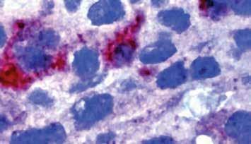 , kappa Specificity: This antibody may be used to examine the biological behavior of tumors.