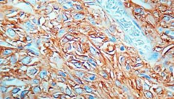 5ml Formalin fixed paraffin embedded human testis stained with DNA polymerase β antibody (Mob 319). Immunogen: BALB/C mice were injected with DNA polymerase β protein.