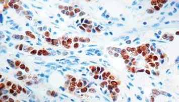 This antibody stains strongly with EBV positive lymphoblastoid cell lines and EBV infected B cell immunoblasts in infectious mononucleosis.