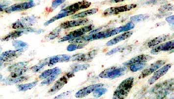 For U.S. market, see index III.) Cultured cells infected with HHV8 stained with HHV8 antibody (Mob 395). Immunogen: Recombinant protein corresponding to the latent nuclear antigen-1 molecule of HHV8.