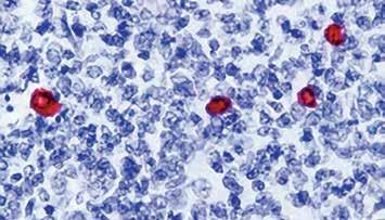5ml PDR 018 Prediluted 6ml PDR018-10RP Prediluted 10ml Formalin fixed paraffin embedded human tonsil stained with IgD antibody (RP 021). Immunogen: IgD isolated from a pool of normal human plasma.