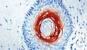 ) Formalin fixed paraffin embedded human pancreas stained with Insulin antibody (Mob 408). Immunogen: Swine insulin.