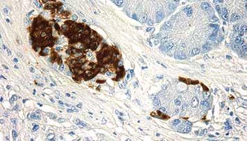 Cross-reaction has been observed with insulin containing cells in fixed sections of pancreas from human. Insulin Clone: K36aC10 Catalog No.: Mob 234 Concentrated 1ml Mob 234-05 Concentrated 0.