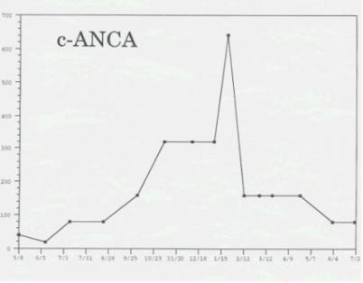 Is ANCA a Reliable Measure of Disease Activity?