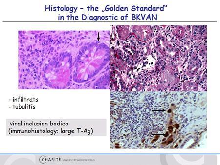 This slide shows you very shortly that the histology is of course, the golden standard for the diagnosis but you see also that you have
