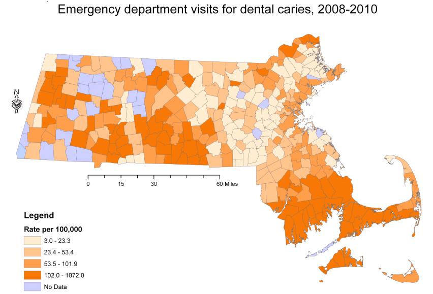 communitywide fluoridation are responsible for the majority of ER