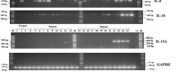 RT-PCR validation on genes from GeneXP assay.
