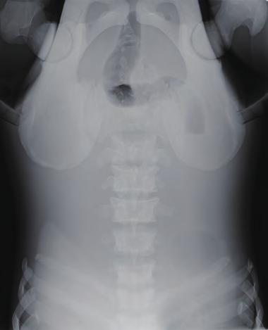 trunk thigh Diaphragm * Not represented when using PBU-50.