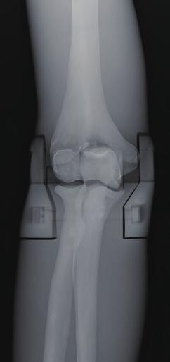 of elbow joint
