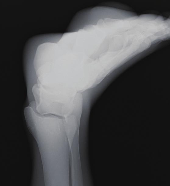 Tibia inferior articular surface Fibula Talocrural joint