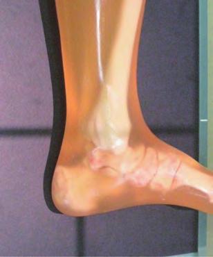 Lower limbs radiography Lateral projection of foot joint