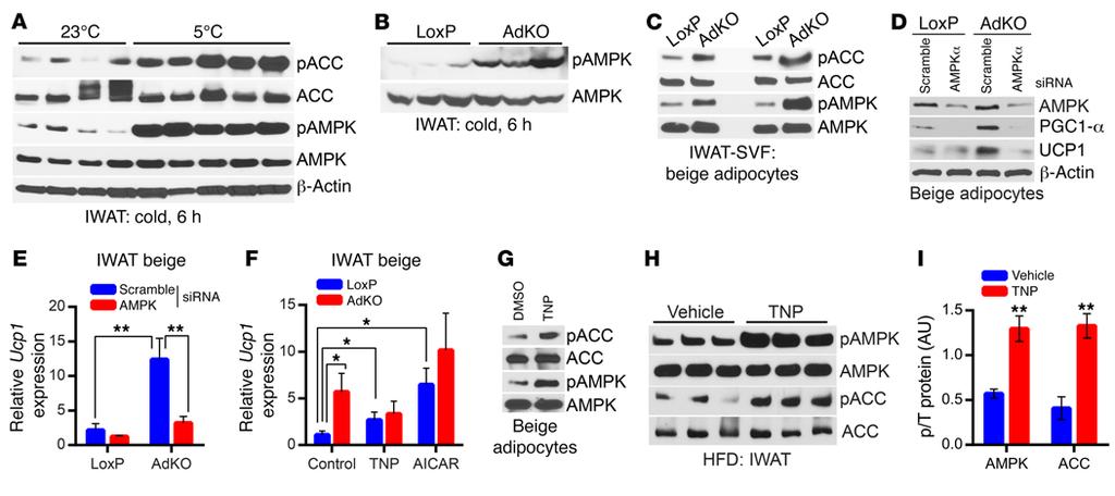 RESEARCH ARTICLE The Journal of Clinical Investigation Figure 6. IP6K1 reduces AMPK-mediated adipocyte browning.