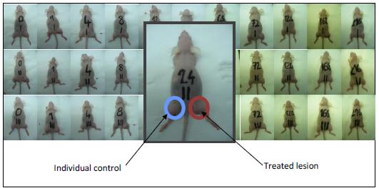 Materials and Methods Animal model: HT29 cell line xenografted to both femoral regions of BalbC/nu/nu mice were treated on one side with a single shot OTM treatment (LabEHY, Oncotherm Ltd, Hungary)